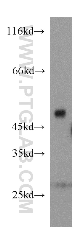 Western Blot (WB) analysis of mouse heart tissue using PAICS Polyclonal antibody (12967-1-AP)