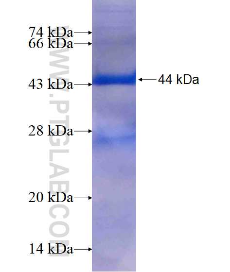 PAICS fusion protein Ag17676 SDS-PAGE