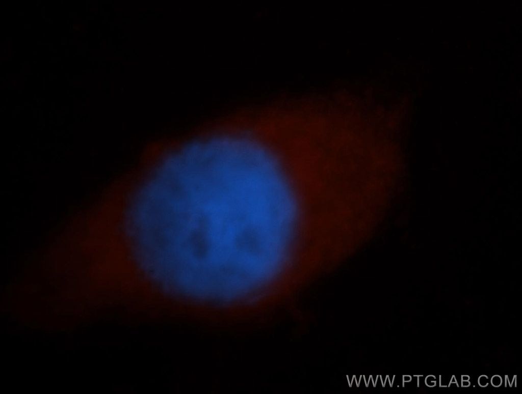 Immunofluorescence (IF) / fluorescent staining of MCF-7 cells using PAIP1 Polyclonal antibody (10675-1-AP)