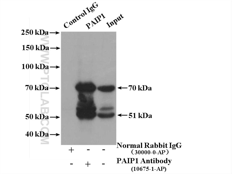 Immunoprecipitation (IP) experiment of HeLa cells using PAIP1 Polyclonal antibody (10675-1-AP)