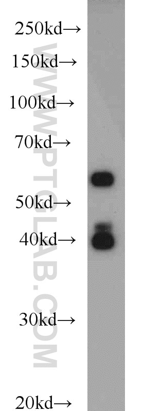 Western Blot (WB) analysis of HeLa cells using PAIP1 Polyclonal antibody (10675-1-AP)