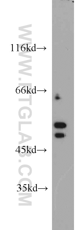 Western Blot (WB) analysis of COS-7 cells using PAIP1 Polyclonal antibody (10675-1-AP)