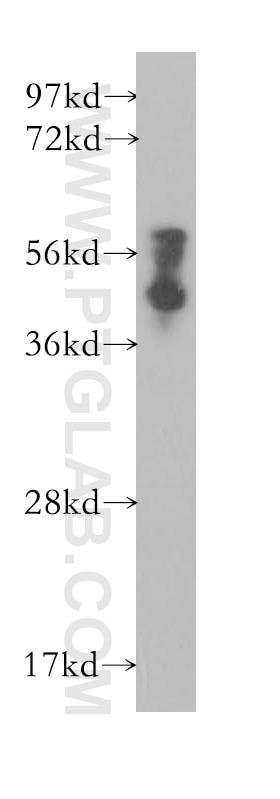Western Blot (WB) analysis of BxPC-3 cells using PAIP1 Polyclonal antibody (10675-1-AP)