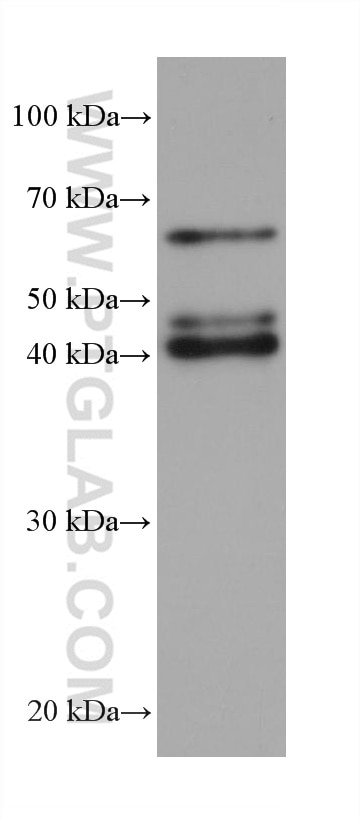 Western Blot (WB) analysis of rabbit brain tissue using PAIP1 Monoclonal antibody (68042-1-Ig)