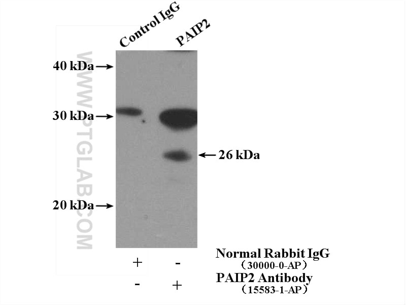 Immunoprecipitation (IP) experiment of A431 cells using PAIP2 Polyclonal antibody (15583-1-AP)