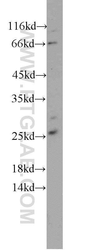 Western Blot (WB) analysis of HeLa cells using PAIP2 Polyclonal antibody (15583-1-AP)