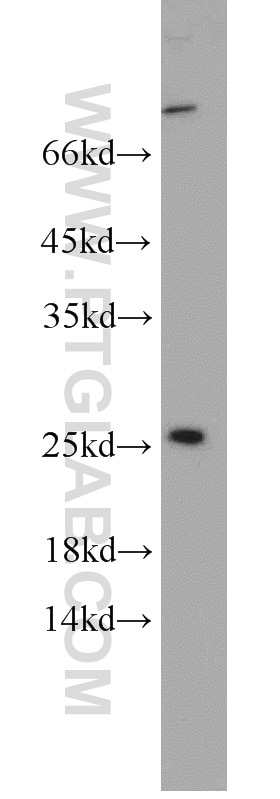 Western Blot (WB) analysis of A431 cells using PAIP2 Polyclonal antibody (15583-1-AP)