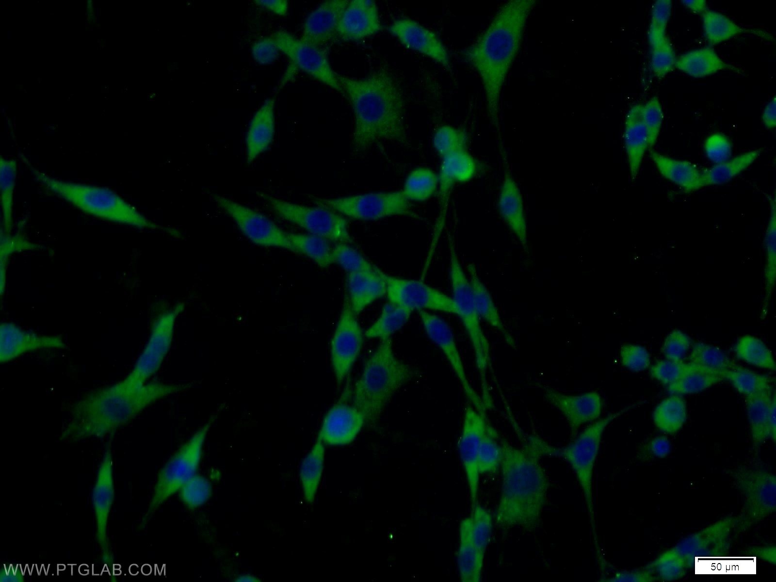 Immunofluorescence (IF) / fluorescent staining of C6 cells using PAK1 Polyclonal antibody (21401-1-AP)