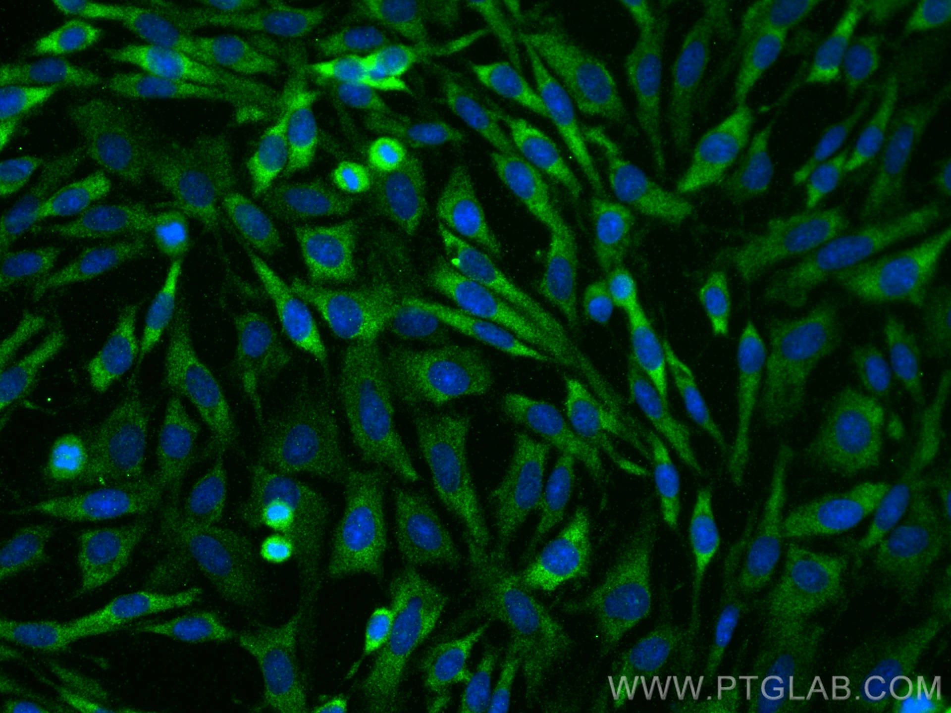 Immunofluorescence (IF) / fluorescent staining of C6 cells using PAK1 Polyclonal antibody (21401-1-AP)