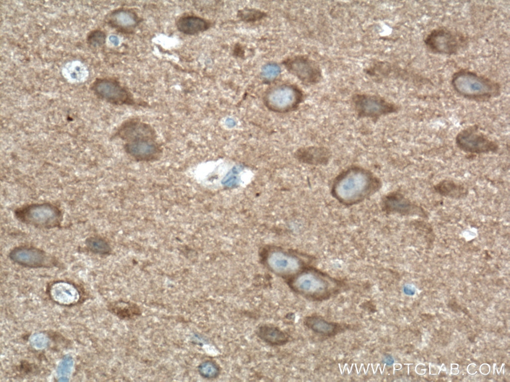 Immunohistochemistry (IHC) staining of mouse brain tissue using PAK1 Polyclonal antibody (21401-1-AP)