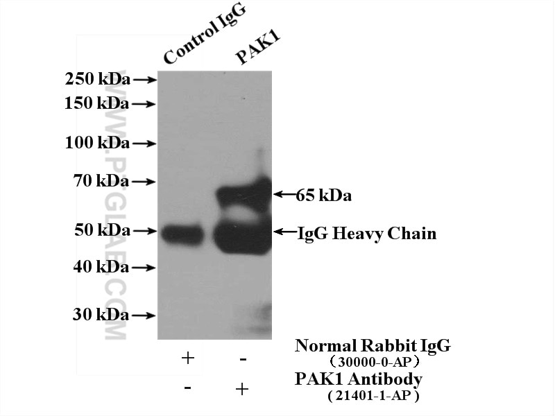 Immunoprecipitation (IP) experiment of K-562 cells using PAK1 Polyclonal antibody (21401-1-AP)