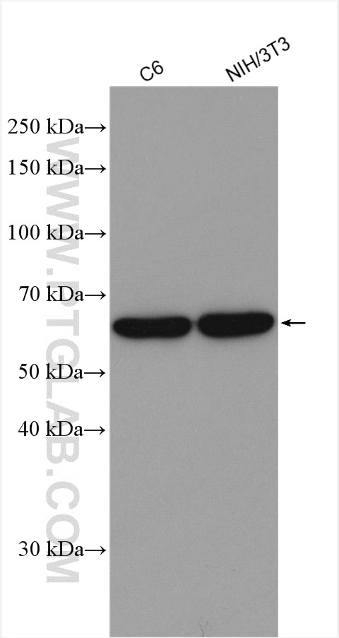 Western Blot (WB) analysis of various lysates using PAK1 Polyclonal antibody (21401-1-AP)