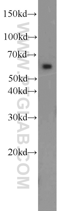 Western Blot (WB) analysis of MCF-7 cells using PAK1 Polyclonal antibody (21401-1-AP)