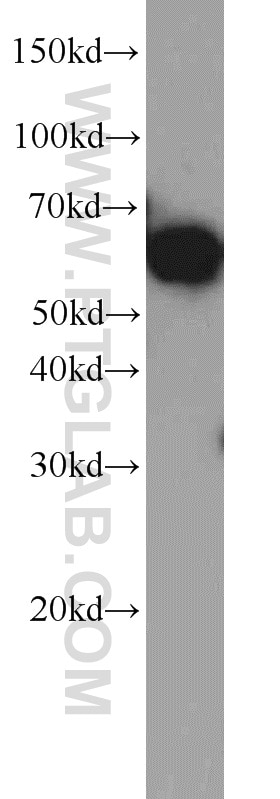 Western Blot (WB) analysis of Jurkat cells using PAK1 Polyclonal antibody (21401-1-AP)