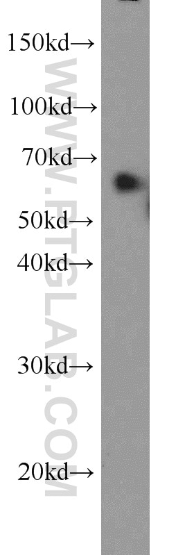 Western Blot (WB) analysis of HeLa cells using PAK1 Polyclonal antibody (21401-1-AP)