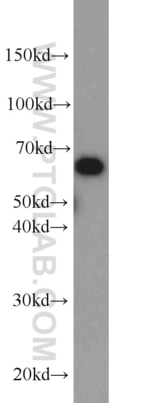 Western Blot (WB) analysis of K-562 cells using PAK1 Polyclonal antibody (21401-1-AP)
