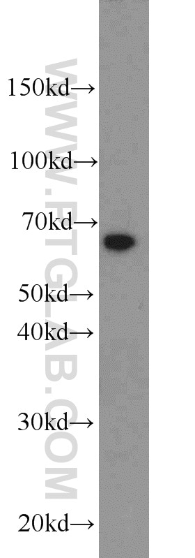 Western Blot (WB) analysis of NIH/3T3 cells using PAK1 Polyclonal antibody (21401-1-AP)
