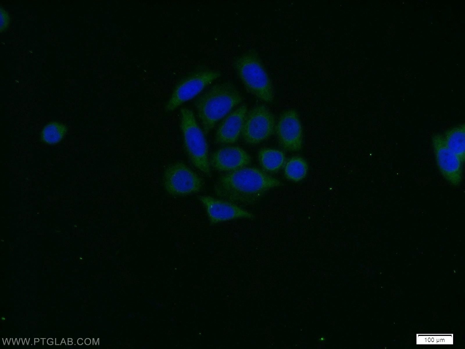 Immunofluorescence (IF) / fluorescent staining of HeLa cells using PAK1 Polyclonal antibody (51137-1-AP)