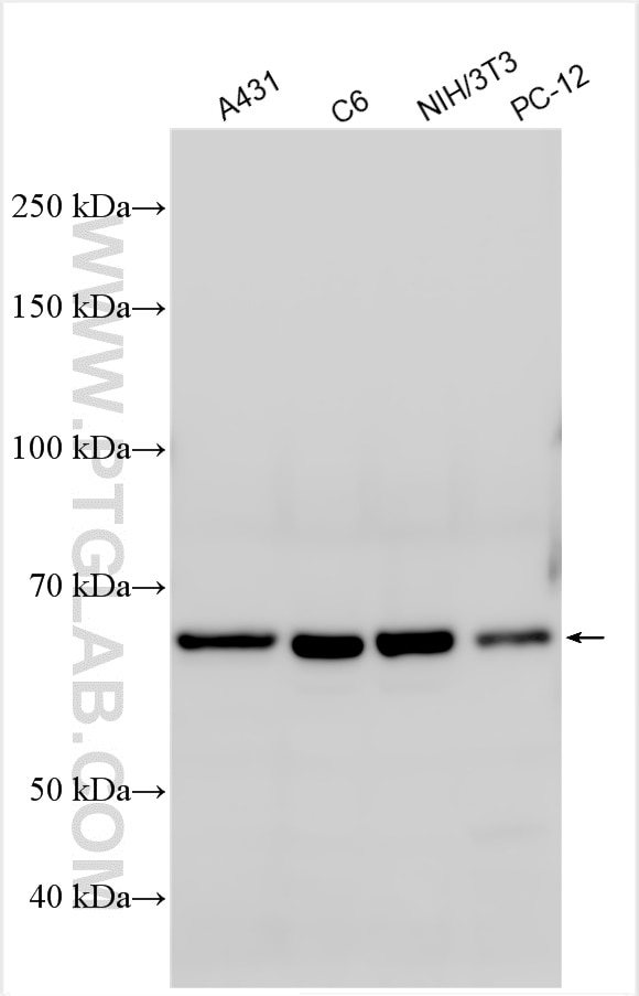 Western Blot (WB) analysis of various lysates using PAK1 Polyclonal antibody (51137-1-AP)