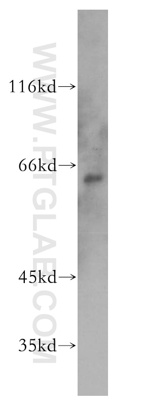 Western Blot (WB) analysis of A431 cells using PAK1 Polyclonal antibody (51137-1-AP)