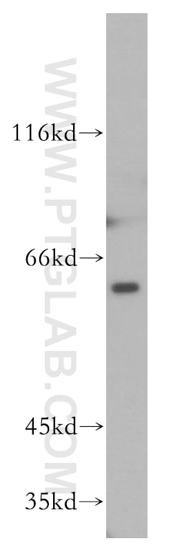 Western Blot (WB) analysis of K-562 cells using PAK1 Polyclonal antibody (51137-1-AP)