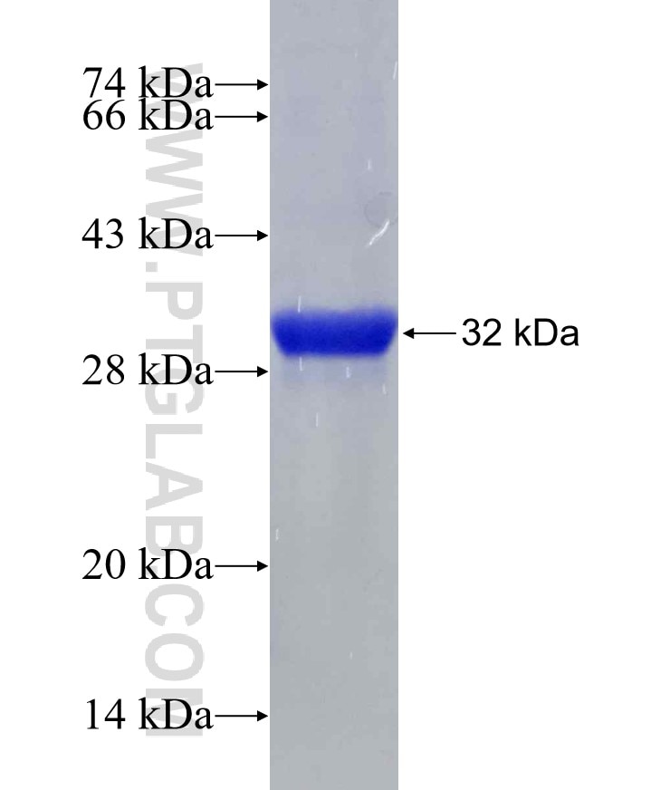 PAK1 fusion protein Ag16102 SDS-PAGE