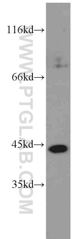 Western Blot (WB) analysis of K-562 cells using PAK1IP1 Polyclonal antibody (16071-1-AP)