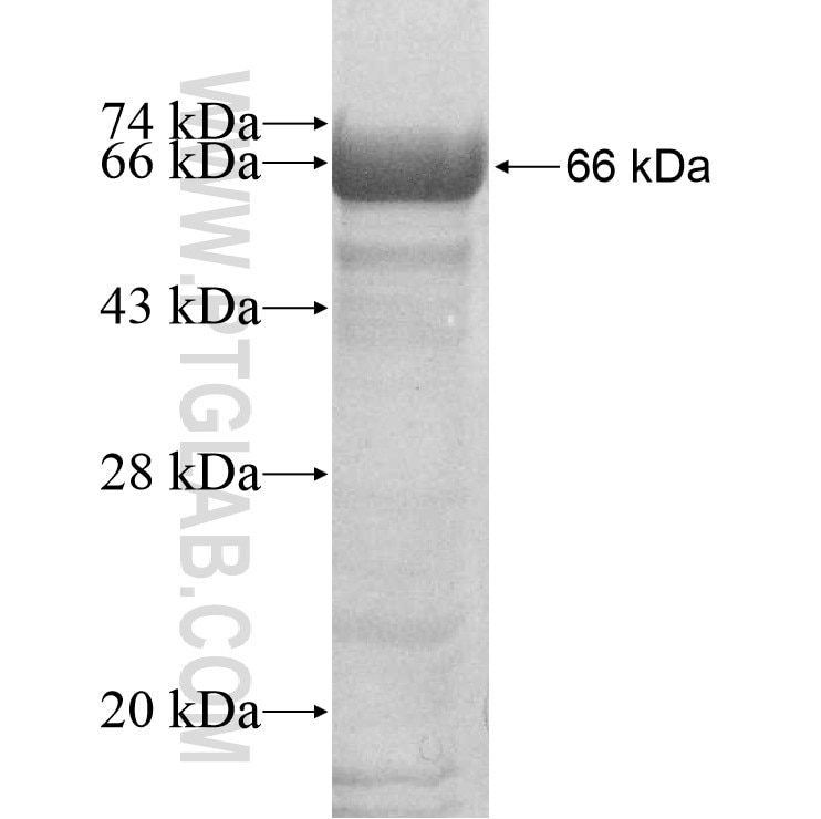 PAK1IP1 fusion protein Ag9016 SDS-PAGE