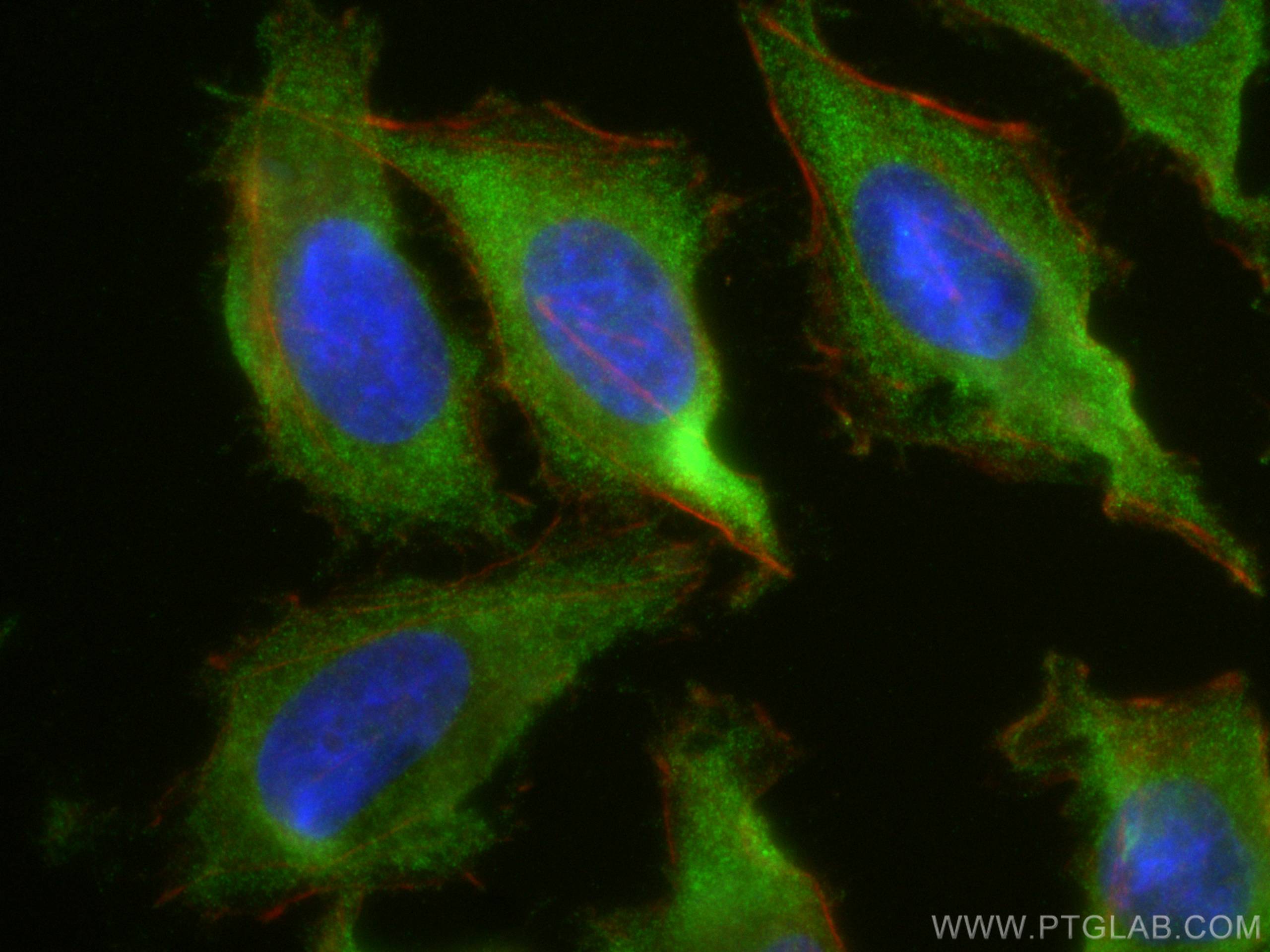 Immunofluorescence (IF) / fluorescent staining of HeLa cells using PAK2 Polyclonal antibody (19979-1-AP)