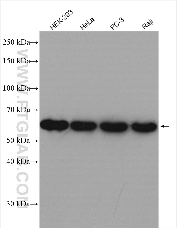 Western Blot (WB) analysis of various lysates using PAK2 Polyclonal antibody (19979-1-AP)