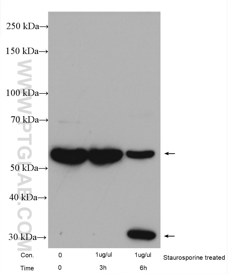 Western Blot (WB) analysis of various lysates using PAK2 Polyclonal antibody (19979-1-AP)