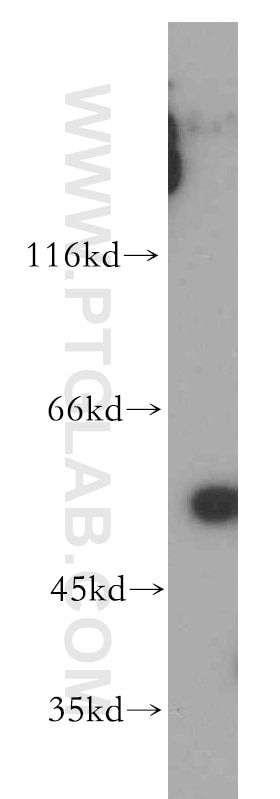 Western Blot (WB) analysis of human skeletal muscle tissue using PAK2 Polyclonal antibody (19979-1-AP)