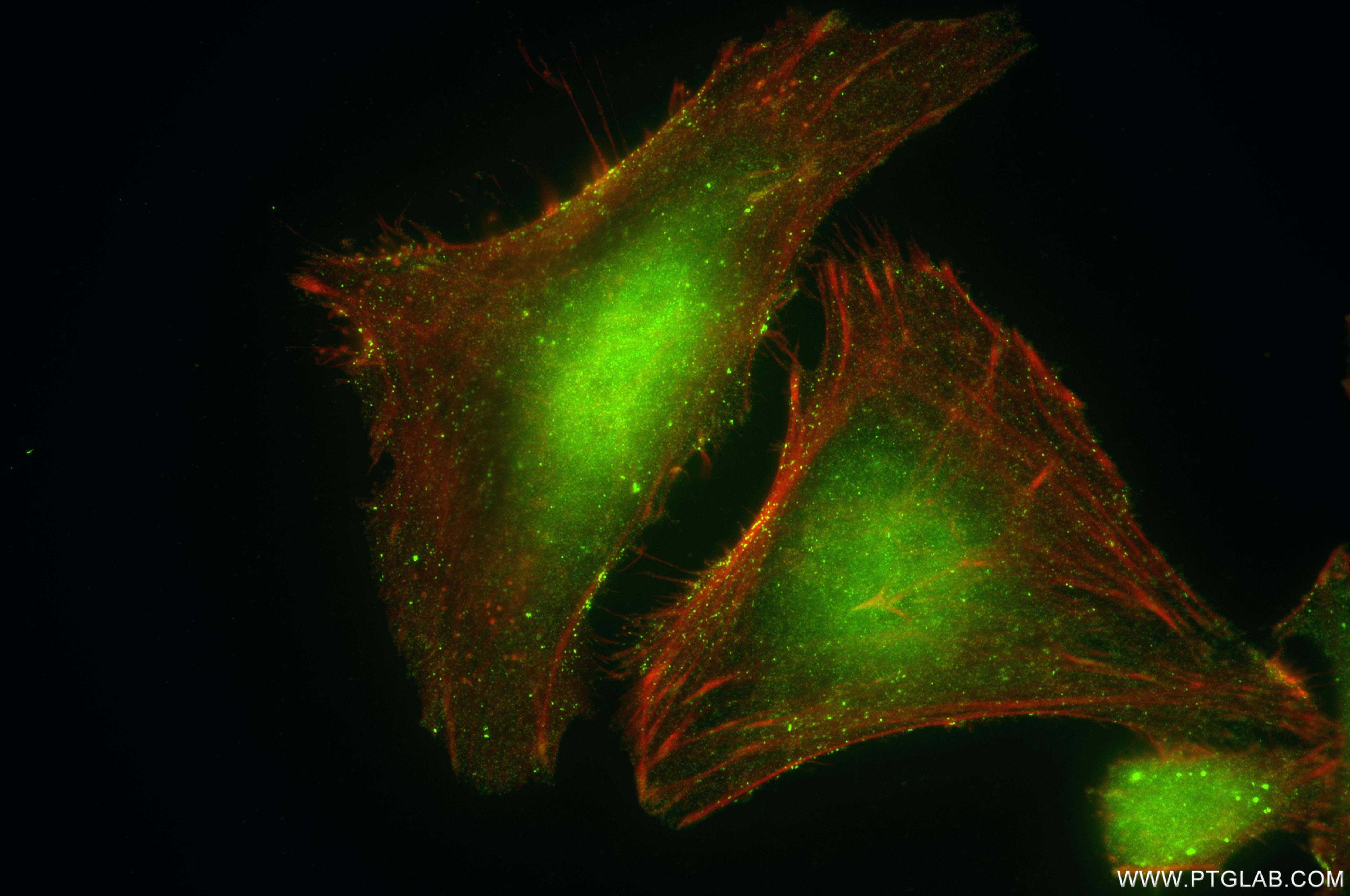 Immunofluorescence (IF) / fluorescent staining of HeLa cells using PAK2 Recombinant monoclonal antibody (85646-2-RR)