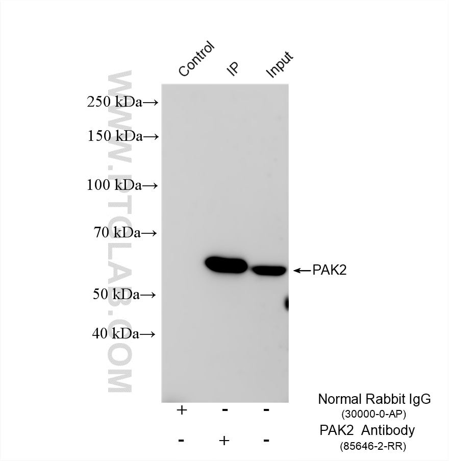 Immunoprecipitation (IP) experiment of HeLa cells using PAK2 Recombinant monoclonal antibody (85646-2-RR)