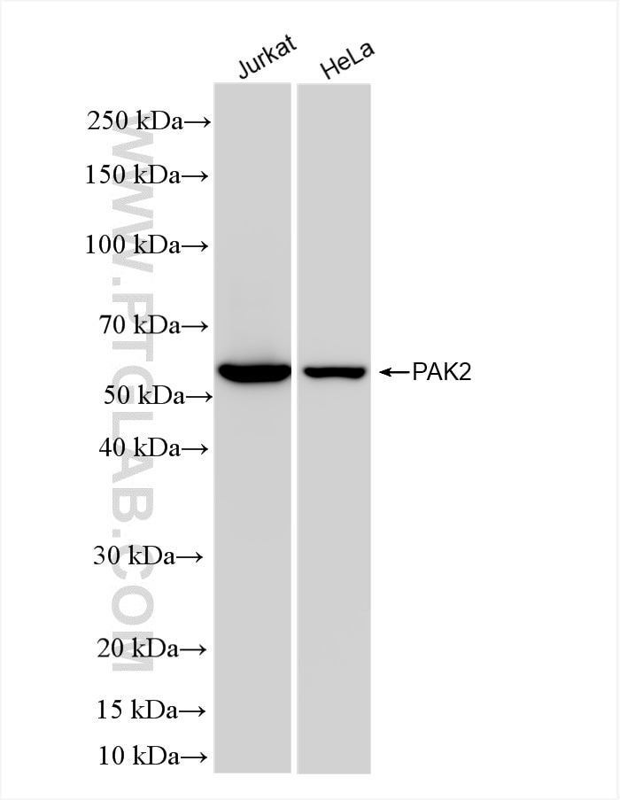 Western Blot (WB) analysis of various lysates using PAK2 Recombinant antibody (85646-2-RR)
