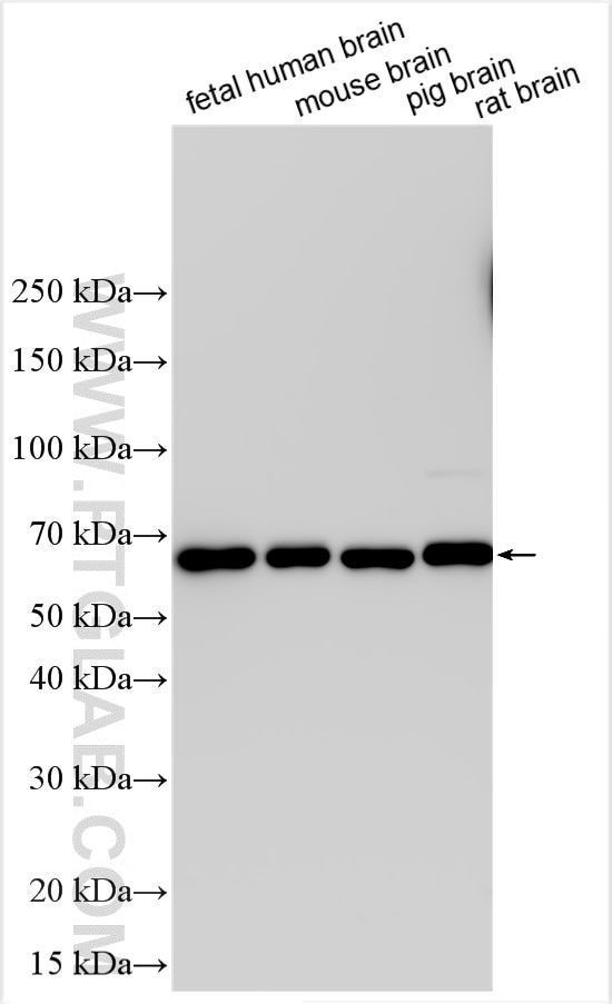 Western Blot (WB) analysis of various lysates using PAK3 Polyclonal antibody (32848-1-AP)