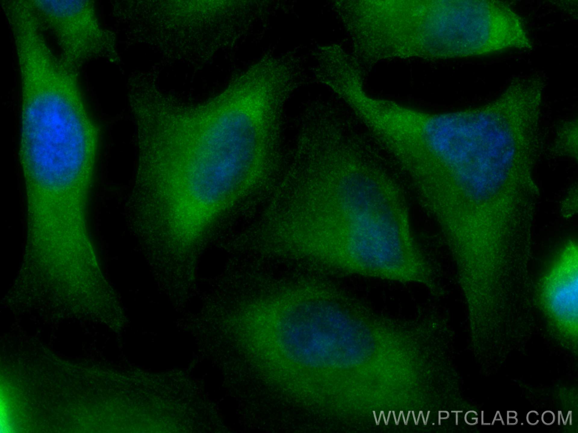 Immunofluorescence (IF) / fluorescent staining of HeLa cells using PAK4 Polyclonal antibody (14685-1-AP)