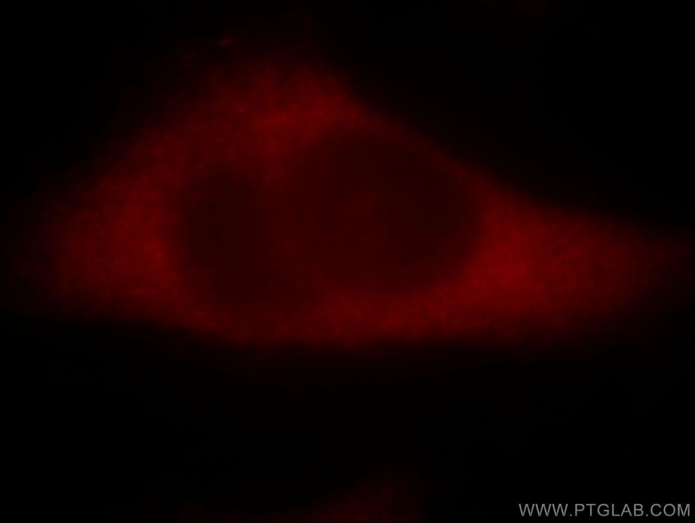 Immunofluorescence (IF) / fluorescent staining of HeLa cells using PAK4 Polyclonal antibody (14685-1-AP)