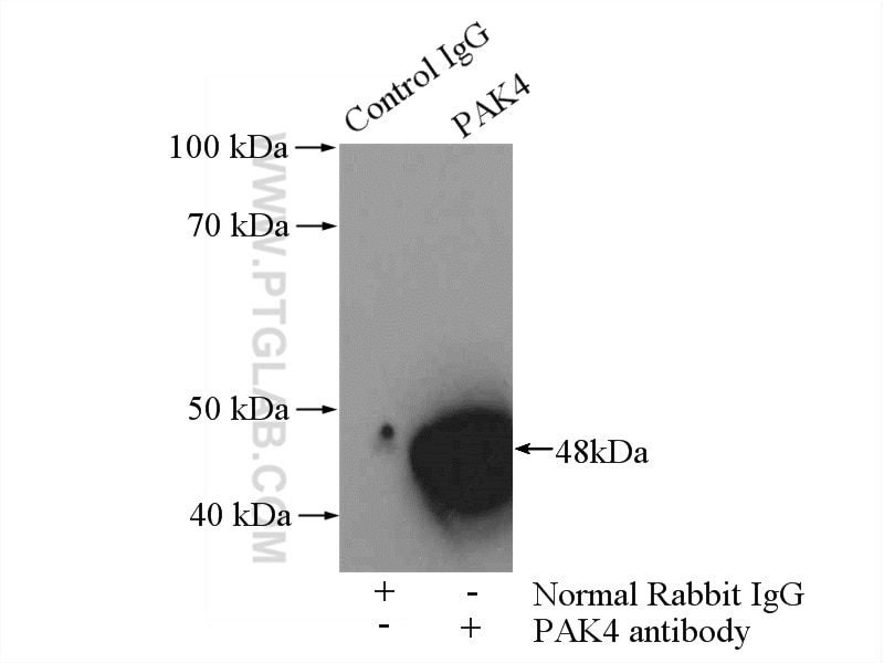Immunoprecipitation (IP) experiment of mouse liver tissue using PAK4 Polyclonal antibody (14685-1-AP)
