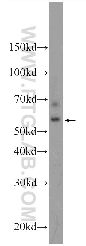 Western Blot (WB) analysis of rat skin tissue using PAK4 Polyclonal antibody (14685-1-AP)