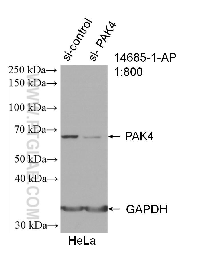 Western Blot (WB) analysis of HeLa cells using PAK4 Polyclonal antibody (14685-1-AP)