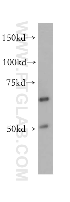 Western Blot (WB) analysis of PC-3 cells using PAK4 Polyclonal antibody (14685-1-AP)