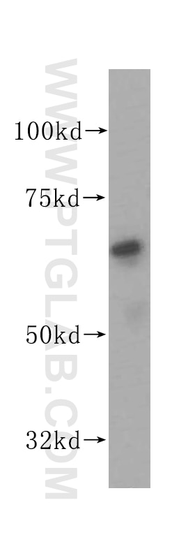 Western Blot (WB) analysis of HeLa cells using PAK4 Polyclonal antibody (14685-1-AP)