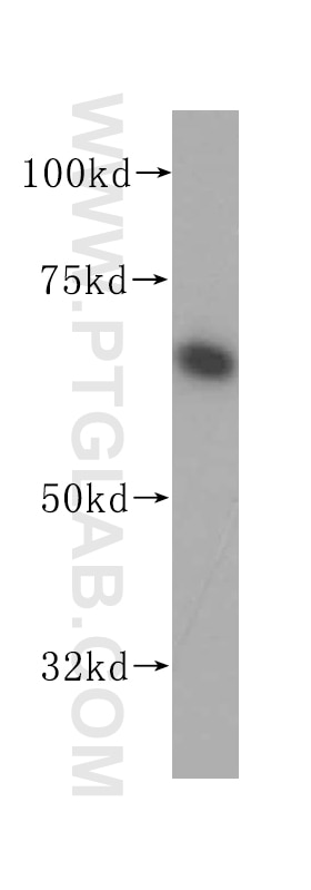 Western Blot (WB) analysis of COLO 320 cells using PAK4 Polyclonal antibody (14685-1-AP)