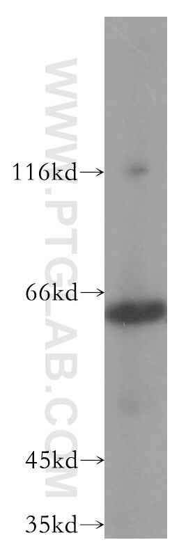 Western Blot (WB) analysis of COLO 320 cells using PAK4 Polyclonal antibody (14685-1-AP)