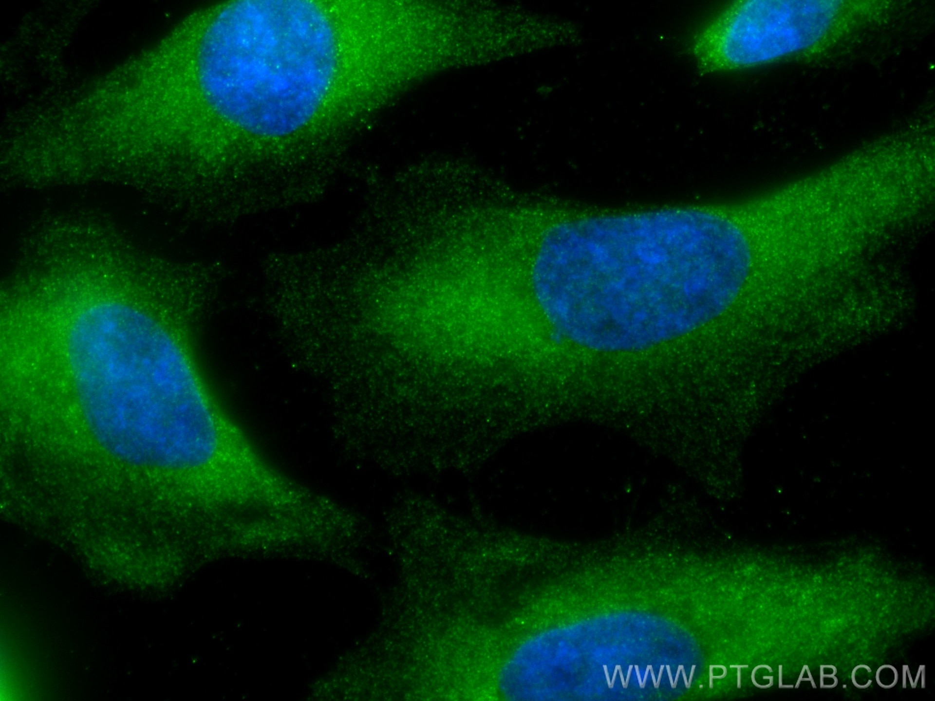 Immunofluorescence (IF) / fluorescent staining of HeLa cells using PAK4 Monoclonal antibody (68298-1-Ig)