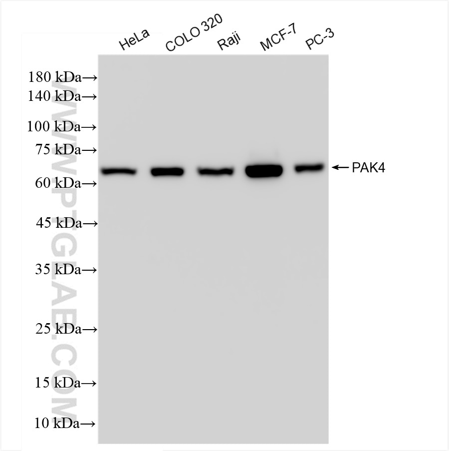 Western Blot (WB) analysis of various lysates using PAK4 Recombinant antibody (83761-5-RR)