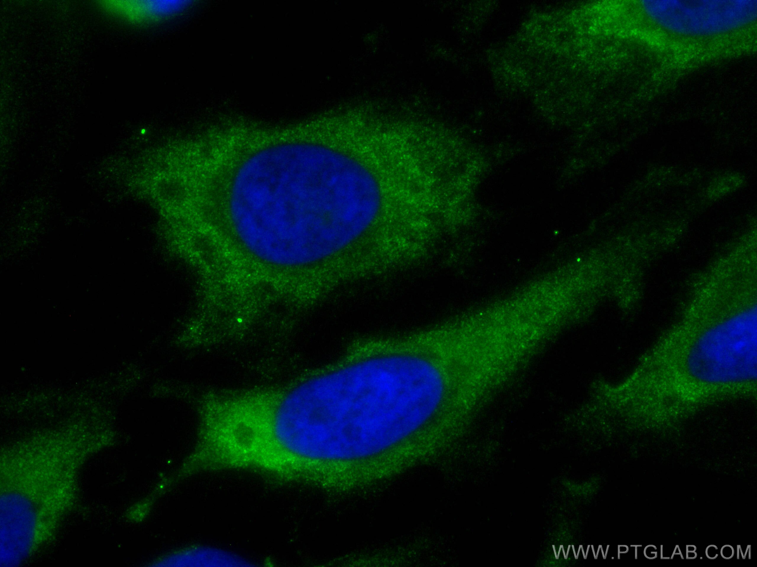 IF Staining of HeLa using CL488-68298