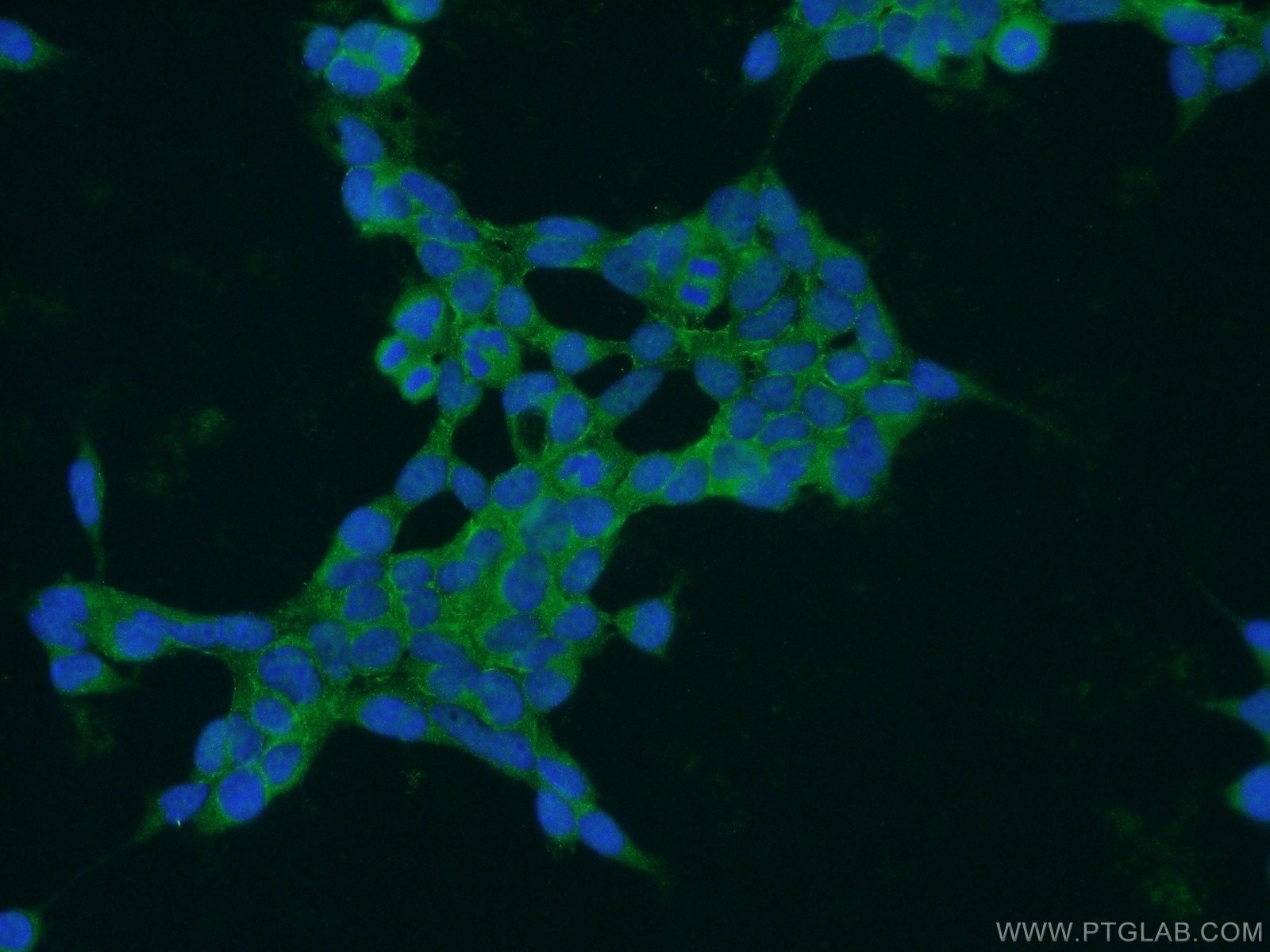 Immunofluorescence (IF) / fluorescent staining of HEK-293 cells using PAK6 Polyclonal antibody (13539-1-AP)