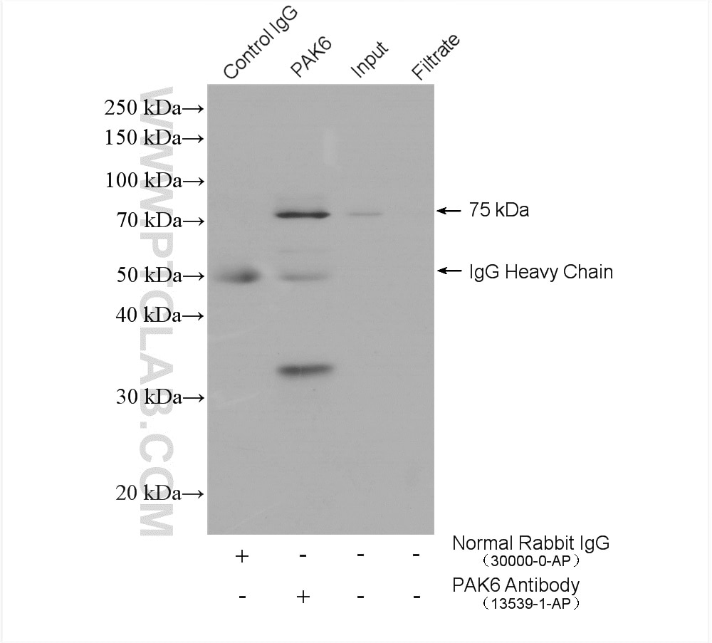 Immunoprecipitation (IP) experiment of mouse testis tissue using PAK6 Polyclonal antibody (13539-1-AP)